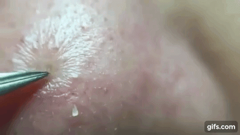 cay nan mun dang duoc chi em ca ngoi va dua nhau lung mua - 1