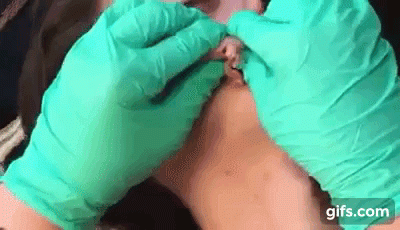 ca nan mun dau trang am anh khien ai cung rung minh - 1
