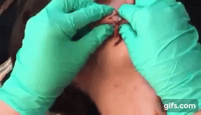 ca nan mun dau trang am anh khien ai cung rung minh - 3