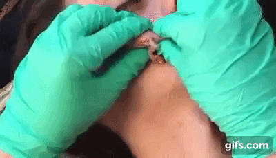 ca nan mun dau trang am anh khien ai cung rung minh - 7