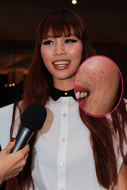 quynh anh, ha anh 'lao dao' vi mat mun - 2