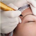 Tin tức - Nghi án thẩm mỹ viện làm chết người, phi tang