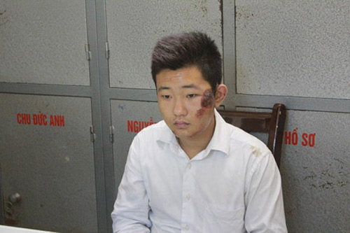 bao ve giup bs vut xac: vi loi hua luong 8 trieu - 1