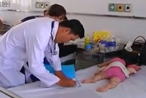 benh nhi benh tay chan mieng co trieu chung khong dien hinh - 2