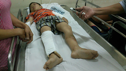 be trai 6 tuoi bi cha duong danh dang xuat huyet nao - 1