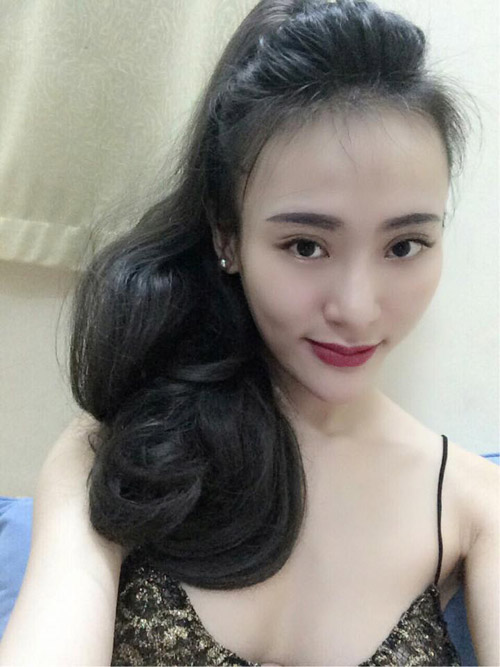 co gai 'lot xac' nho tiem chat lam day de mat thon, cam nhon - 4