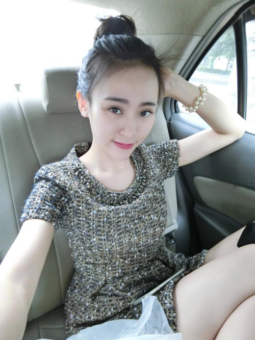 co gai 'lot xac' nho tiem chat lam day de mat thon, cam nhon - 6