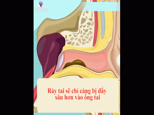 bai hoc nho doi cua ba me co thoi quen dung bong ngoay tai con - 2