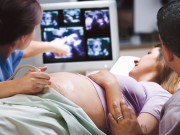 Cách đọc kết quả siêu âm thai chuẩn như bác sĩ