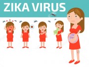 Tất cả những điều về virus Zika mẹ bầu cần biết