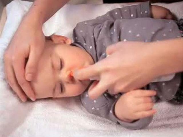Cháu bé 12 tháng tuổi nhập viện vì bị rửa mũi nhầm bằng cồn 90 độ