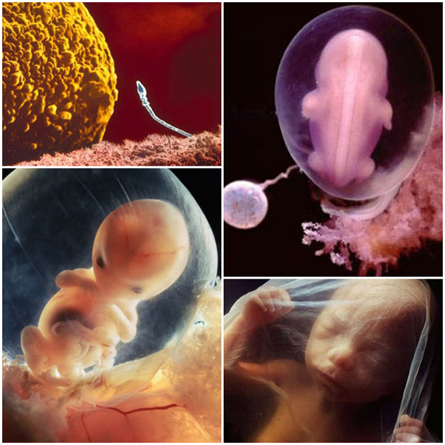 Bộ ảnh 'Sự lớn lên của bào thai’ được thực hiện bởi nhiếp ảnh gia người Thụy Điển Lenartoma Nilsson. Ông đã dành 12 năm tâm huyết để có được những hình ảnh chi tiết nhất về sự hình thành và phát triển của thai nhi trong bụng mẹ. Điều đặc biệt là những bức ảnh này được chụp chỉ với máy ảnh thông thường với ống kính macro, nội soi và kính hiển vi điện tử.

Nhiếp ảnh gia Nilsson đã sử dụng mức độ phóng đại hàng trăm ngàn lần. Bức ảnh đầu tiên về bào thai người được công bố năm 1965. Bộ ảnh được đặt tên: 'A Child is Born' (Tạm dịch: Sự lớn lên của bào thai).

Bộ ảnh sẽ cho cha mẹ có cơ hội “mục sở thị” những khoảnh khắc lớn lên diệu kỳ của thai nhi trong bụng mẹ. Mời các bạn cùng chiêm ngưỡng bộ ảnh.
