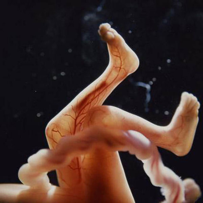 Bộ xương chưa được hình thành, có thể nhìn thấy rõ ràng các mạch máu khắp cơ thể thai nhi.
