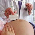 Siêu âm có gây hại gì cho thai nhi?