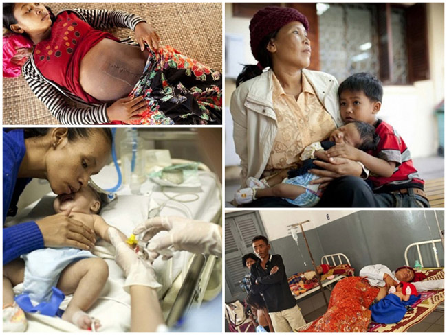 Bộ ảnh 'một ngày ở bệnh viện sản khoa Campuchia' được thực hiện bởi nhiếp ảnh gia Bernice Wong. Lý do mà nhiếp ảnh gia chọn chụp bộ ảnh này là do tỷ lệ tử vong ở trẻ sơ sinh ngay khi vừa lọt lòng mẹ của đất nước này rất cao (1/33 trẻ). 

Không chỉ có thế, tỷ lệ tử vong ở trẻ sơ sinh ở những vùng nông thôn còn cao gấp 3 lần so với thành phố.
