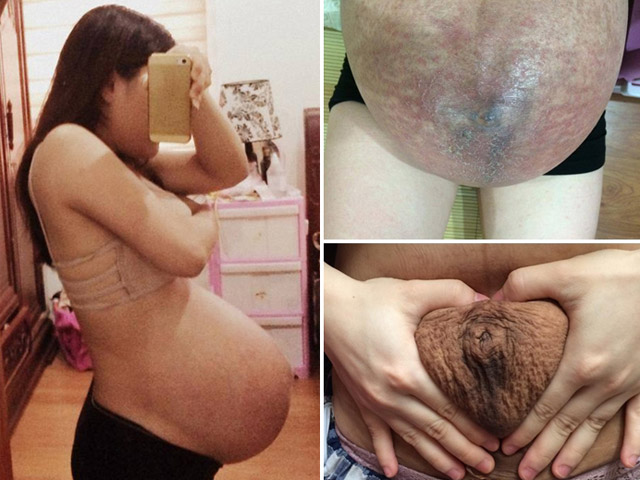 Hình ảnh bụng bầu rỉ máu khiến nam giới cũng phải xót xa