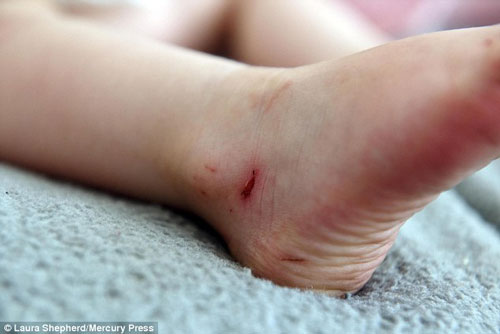 Tin tức 24h: Bé 2 tuổi máu chảy đầm đìa vì đôi dép được bán phổ biến