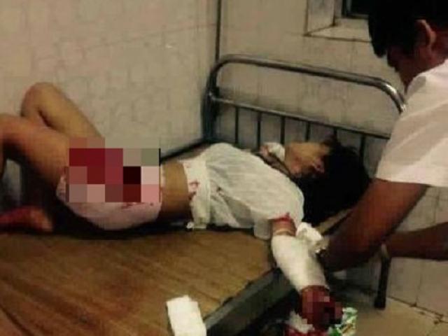 Giận người yêu, thiếu nữ 16 tuổi lấy dao rạch tay tự tử ngay trước mặt
