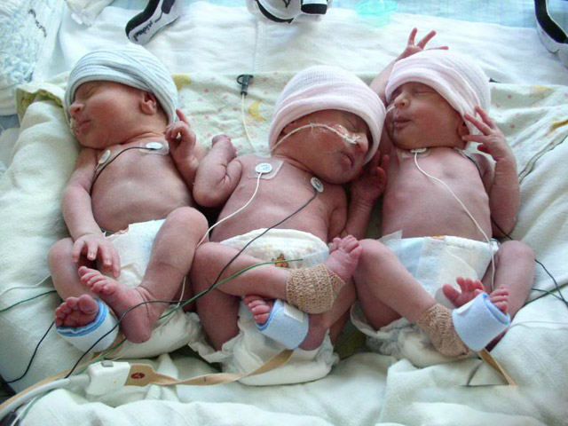 Siêu âm thai bình thường, ca sinh 3 chào đời khiến ekip đỡ đẻ sửng sốt