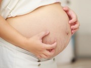 Cách trị ngứa khi mang thai đơn giản lại hiệu quả ngay tại nhà