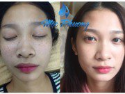 Làm đẹp mỗi ngày - Thẩm mỹ Mộc Phương tung khuyến mãi “khủng” mừng ngày Nhà giáo Việt Nam