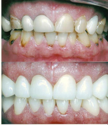 Địa chỉ tin cậy cho hàm răng khỏe đẹp - 2