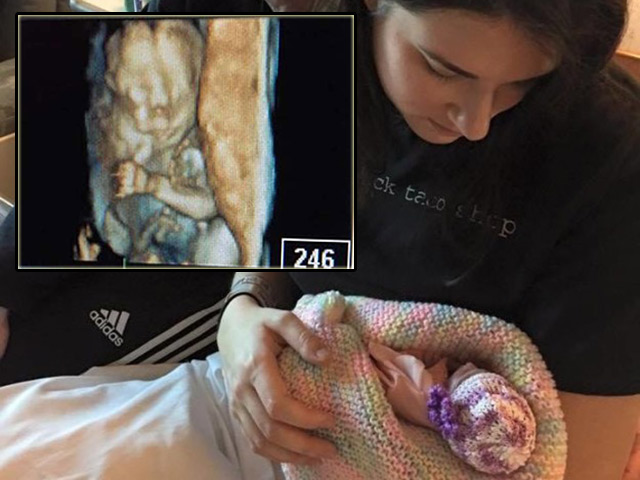 Siêu âm dị tật, mẹ bầu 6 tháng đau đớn phá thai, khi lấy em bé ra tất cả sững sờ