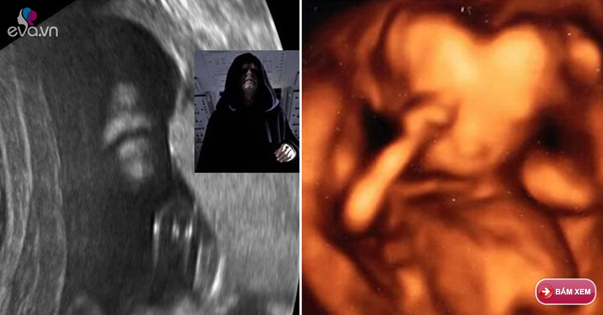 10 hình ảnh siêu âm thai khiến người xem giật mình - eva