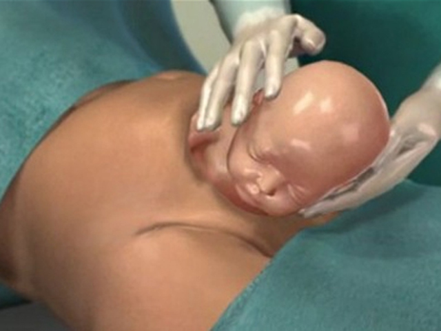 Káº¿t quáº£ hÃ¬nh áº£nh cho Äáº» má»