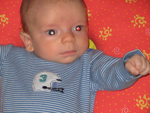 Xem ảnh sơ sinh của con bị ung thư mắt bố rùng mình phát hiện điều kỳ lạ