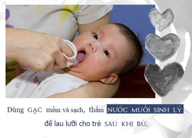 tre bi nam luoi: cac phuong phap dieu tri hieu qua va an toan - 4