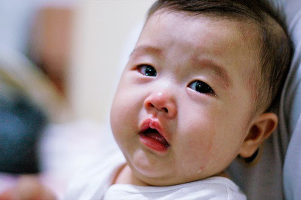 Trẻ 1 tuổi lười ăn phải làm sao? - 1