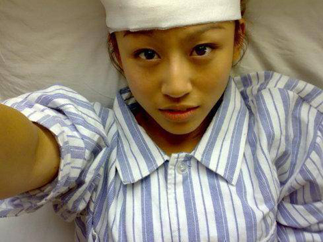Cô gái 22 tuổi qua đời vì ung thư gan: 3 thói quen xấu đến sức khỏe người trẻ cần dừng ngay lập tức
