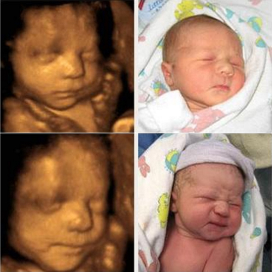Tìm hiểu hình ảnh siêu âm 4d giống lúc đẻ ra không qua các giai đoạn của thai kỳ
