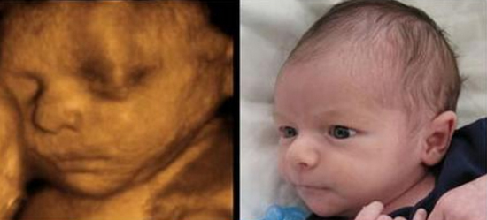 Siêu âm thai nhi - Những bức ảnh siêu âm thai nhi sẽ giúp bạn có cơ hội đón nhận các khoảnh khắc đáng yêu và tuyệt vời của những phút giây trong cuộc đời của con bạn và mẹ. Hãy thưởng thức những khoảnh khắc tràn đầy hạnh phúc với siêu âm thai nhi.