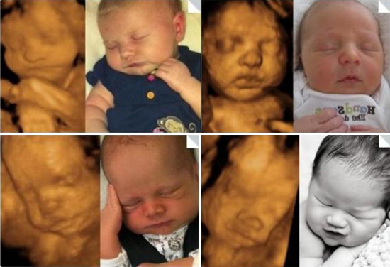 Những bức ảnh siêu âm thai không chỉ ghi nhận lại dấu ấn mà còn đưa bạn đến gần hơn với con yêu trong từng giây phút tiếp tục phát triển. Hãy trải nghiệm điều đó bằng việc xem qua những bức ảnh này.