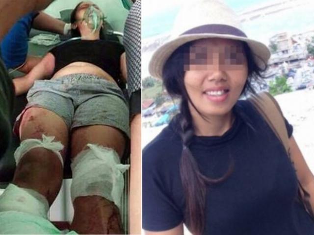 Nghi ngờ vợ lăng nhăng, chồng chém đứt bàn chân vợ trước mặt 2 con nhỏ