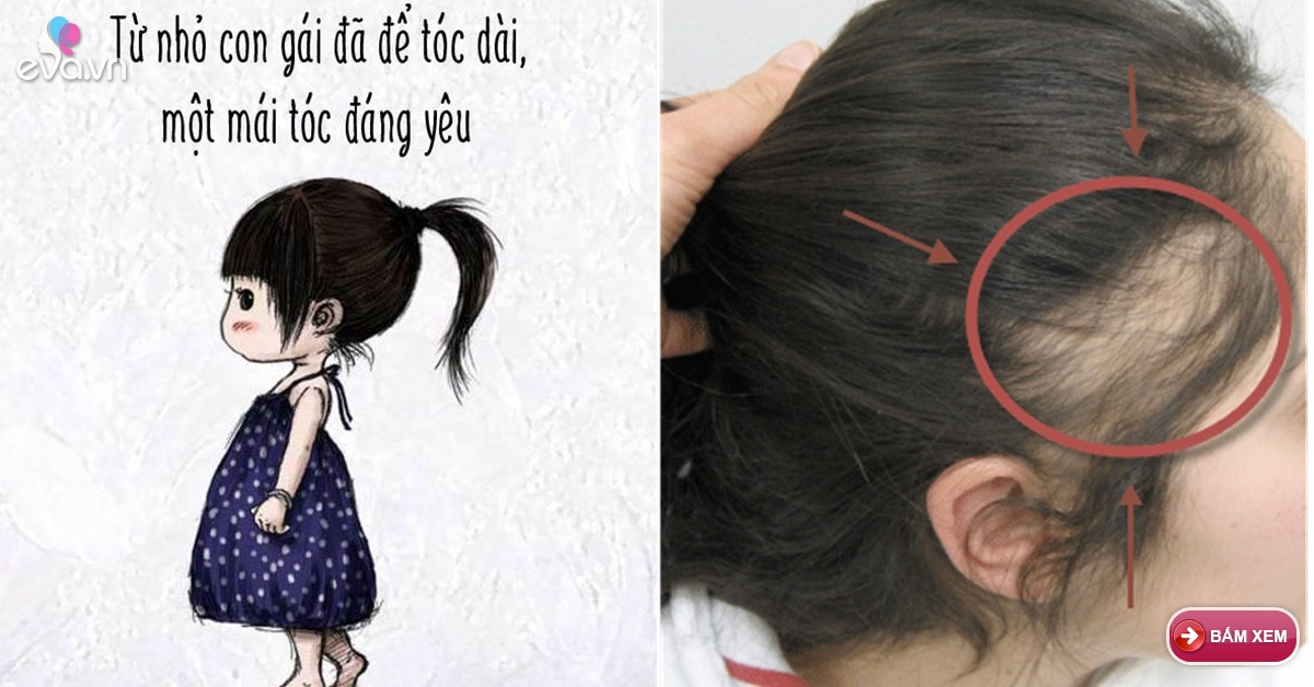 Thói quen buộc tóc cho con mẹ Việt nên tránh nếu không muốn con bị hói   Khoa học và Đời sống