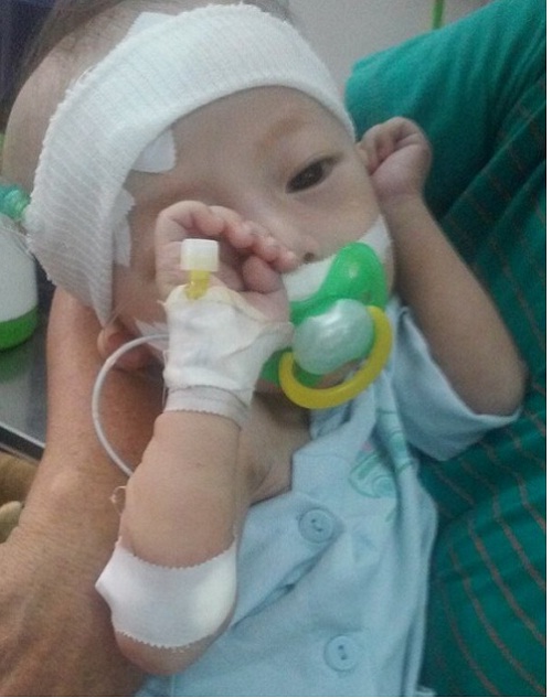 Nước mắt cạn khô của người mẹ 1 năm ròng chăm sóc con trai 12 tháng bị liệt ruột