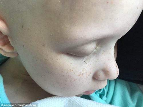 Điều kỳ diệu xảy ra với bé gái ung thư trong bức ảnh sợi lông mi cuối cùng nổi tiếng