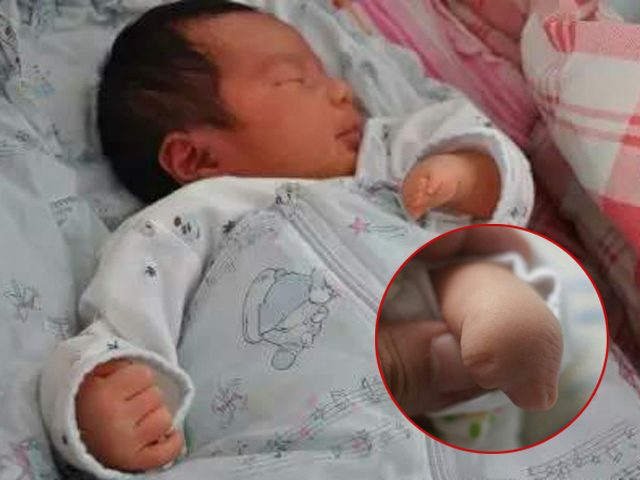 Con sinh ra không có ngón tay, biết nguyên nhân mẹ ôm đầu hối hận