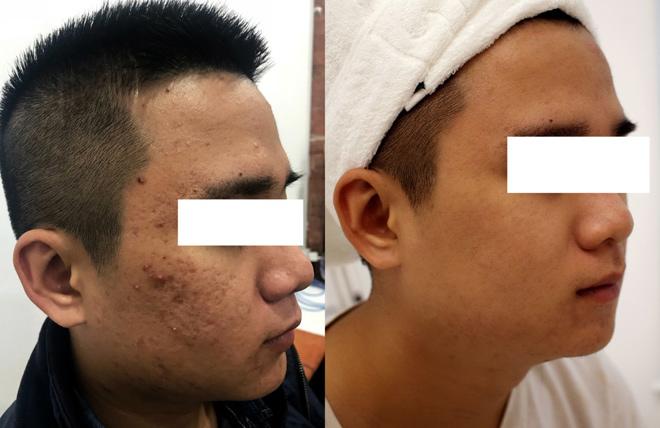 da muot mat xinh, cung rinh tai loc voi evie clinic & spa - 4